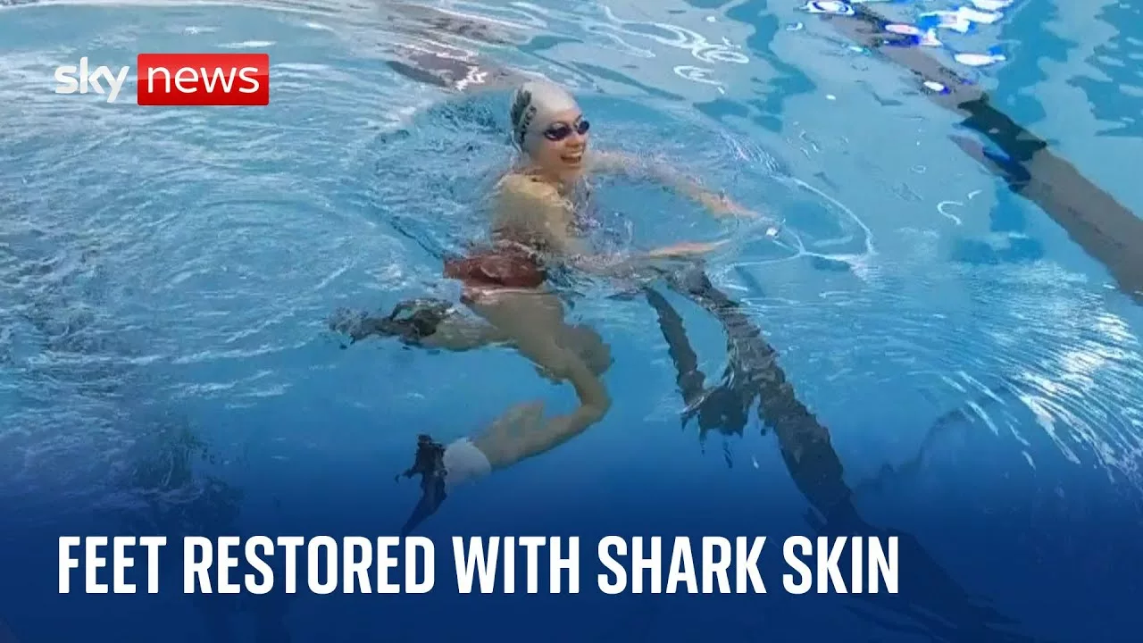 Swimmer’s Feet Restored With Shark Cartilage and Skin After Being Crushed | Sky News