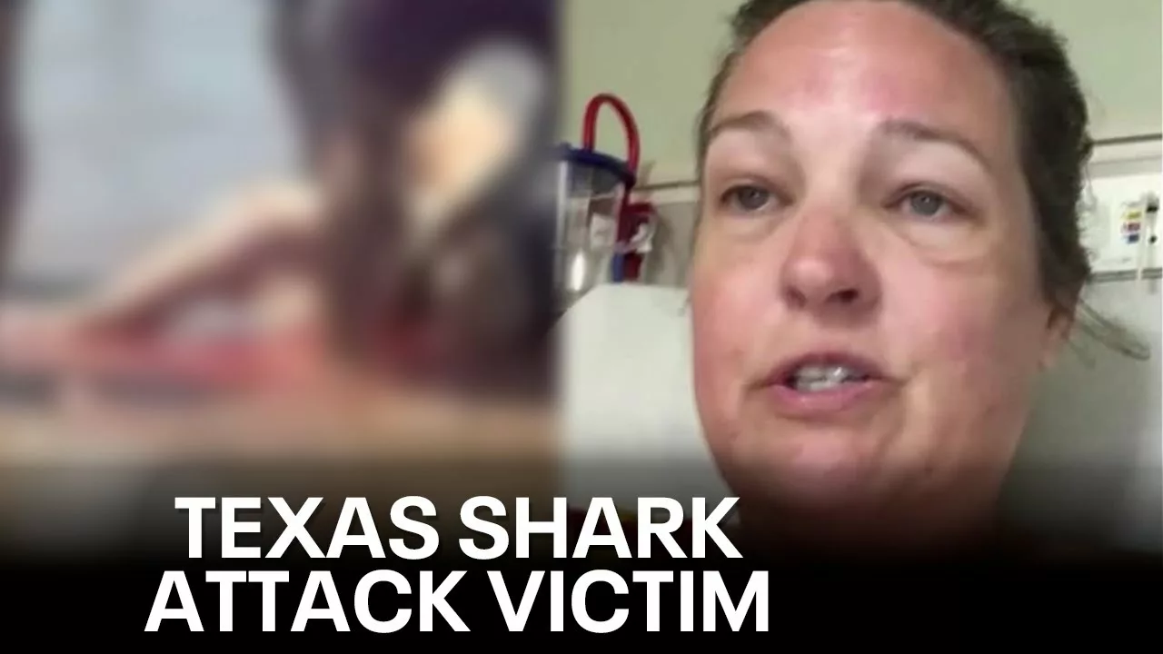 North Texas Woman Attacked by Shark in South Padre: ‘I Thought It Was a Big Fish’ | FOX 4 Dallas-Fort Worth