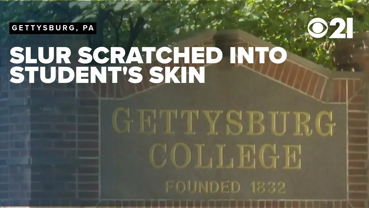 Racial Slur Scratched Into Student’s Skin; 2 College Swimmers Suspended | CBS 21 News